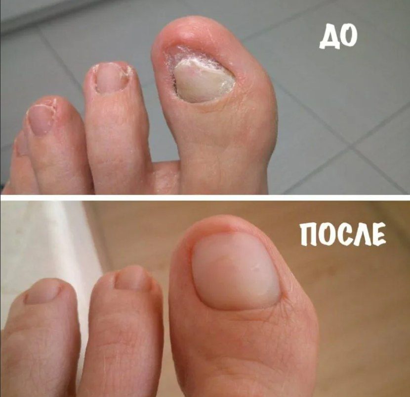 Фото процедуры